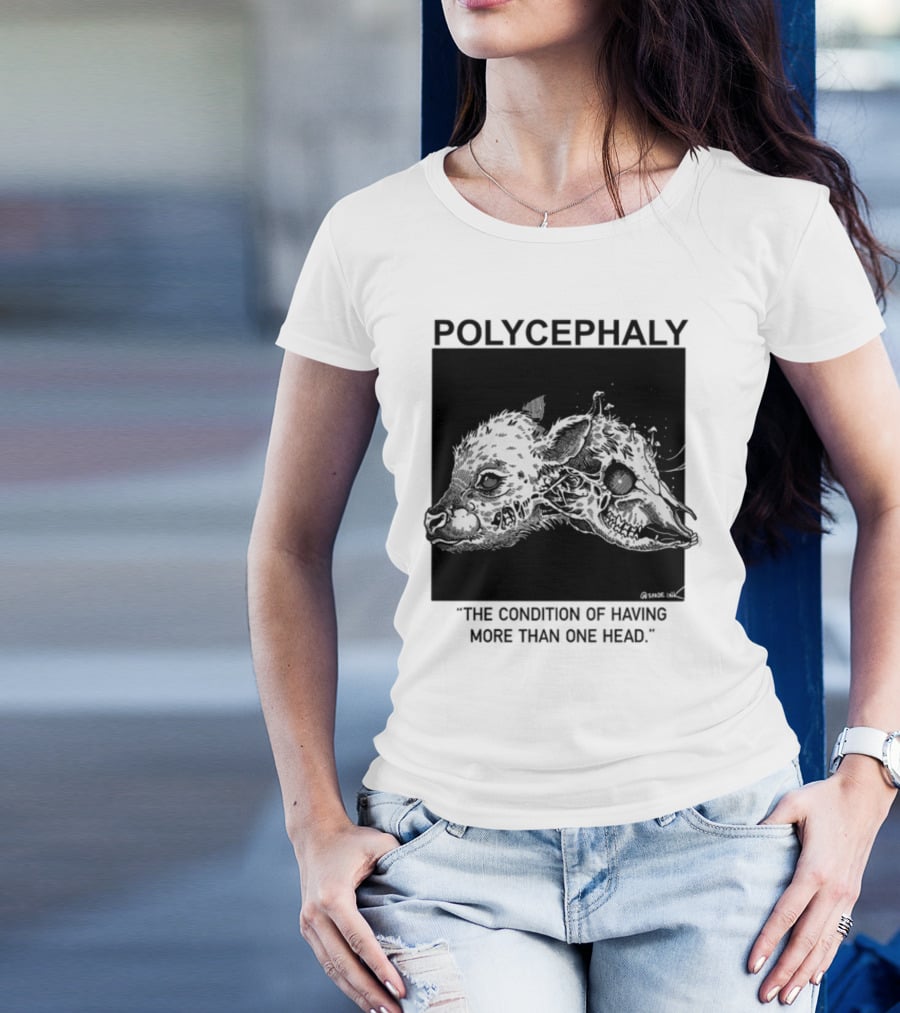 Polycephaly The Condition Of Having More Than One Head T-Shirt