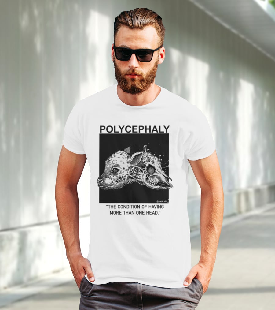 Polycephaly The Condition Of Having More Than One Head T-Shirt