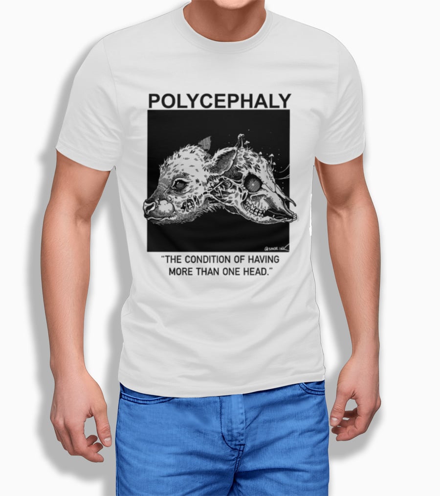 Polycephaly The Condition Of Having More Than One Head T-Shirt