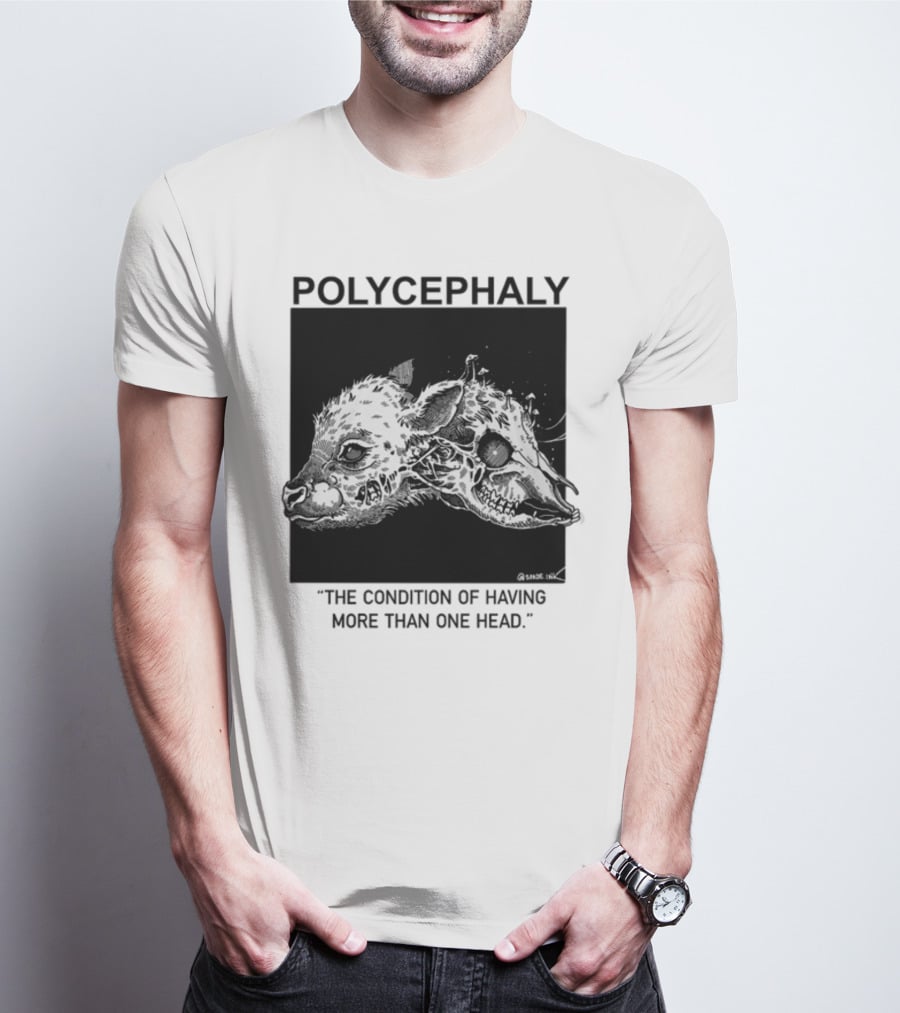 Polycephaly The Condition Of Having More Than One Head T-Shirt