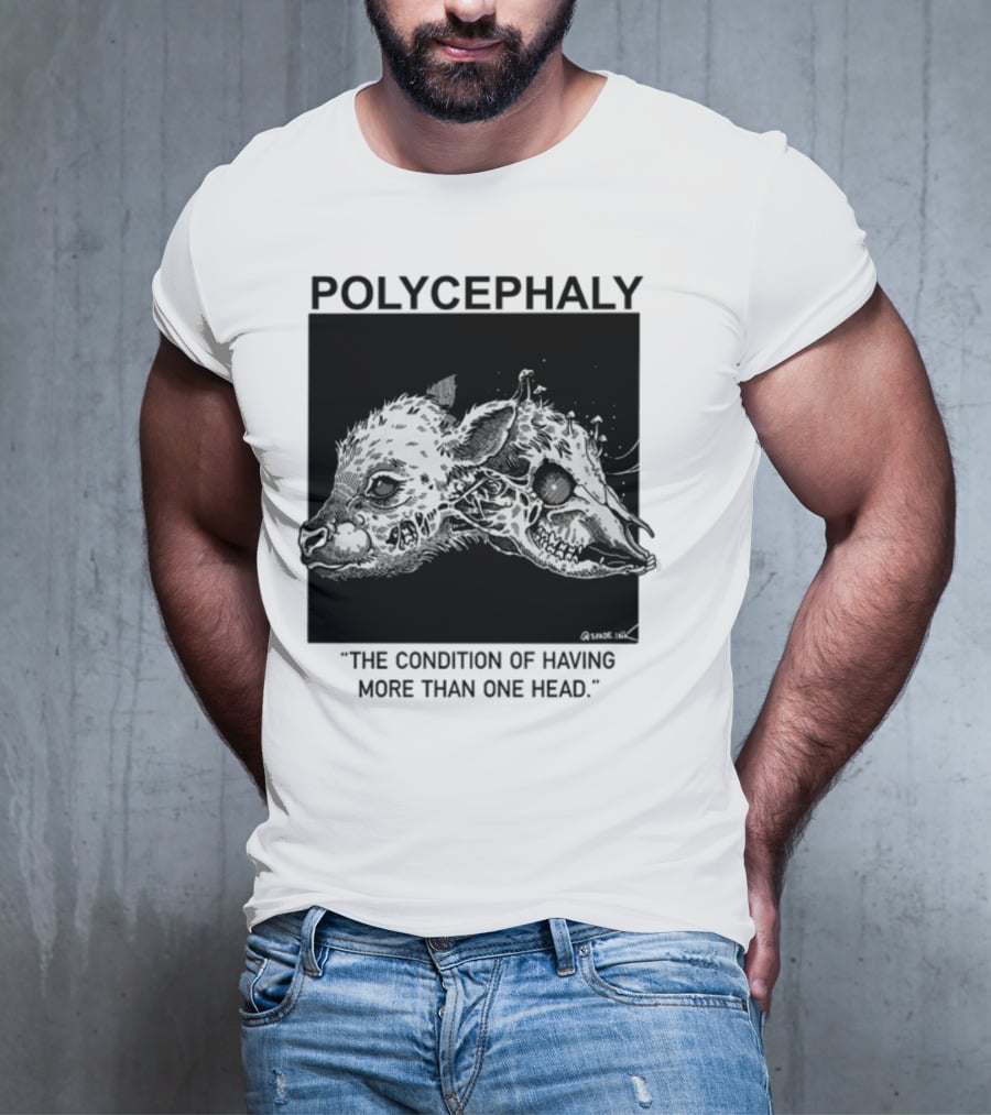Polycephaly The Condition Of Having More Than One Head T-Shirt