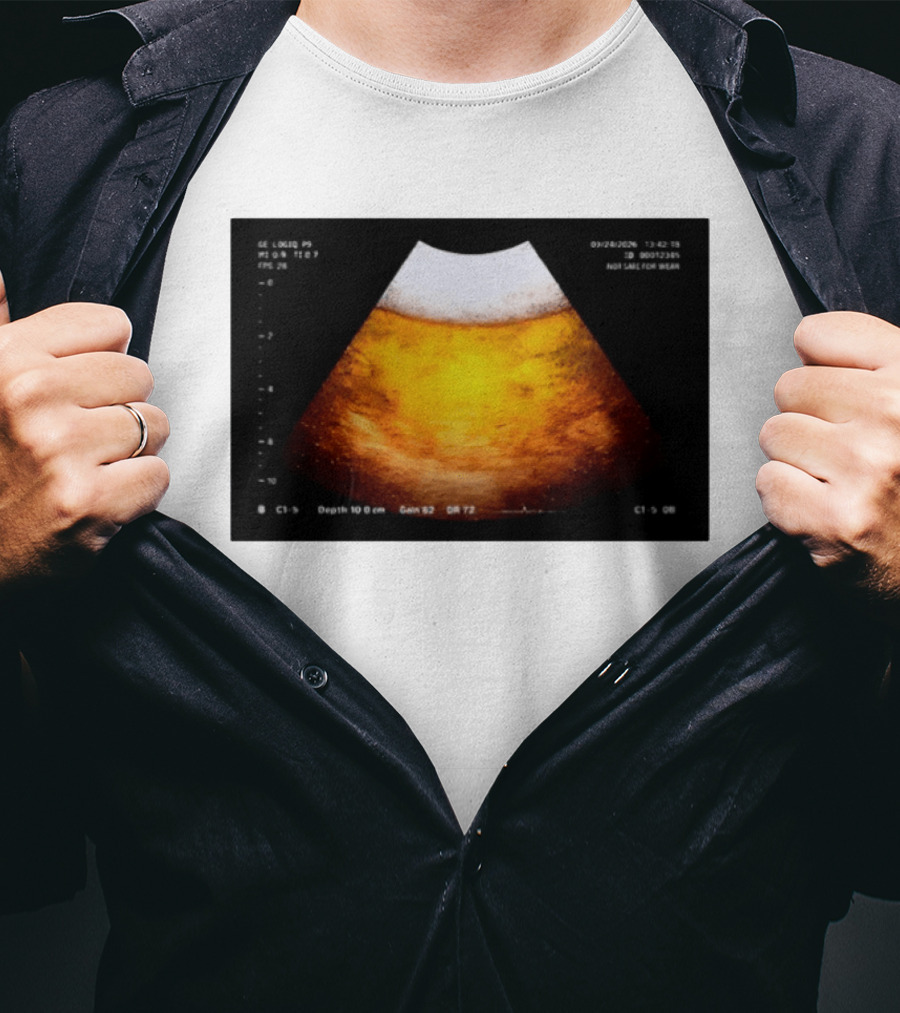 Beer Ultrasound Image Not Safe For Liver T-Shirt