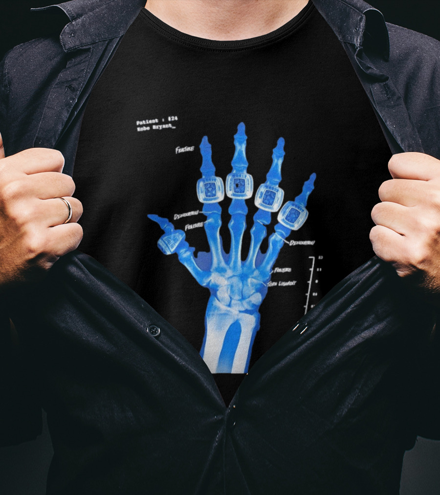 Kobe Bryant Patient No 24 X Ray Rings Lakers T-Shirt