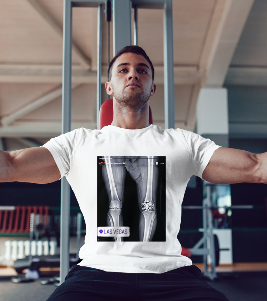 Conor McGregor X Ray Broken Knee Las Vegas T-Shirt