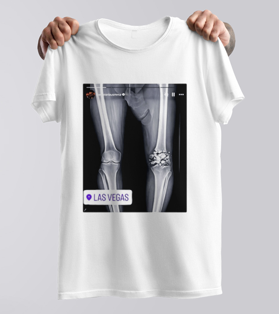 Conor McGregor X Ray Broken Knee Las Vegas T-Shirt