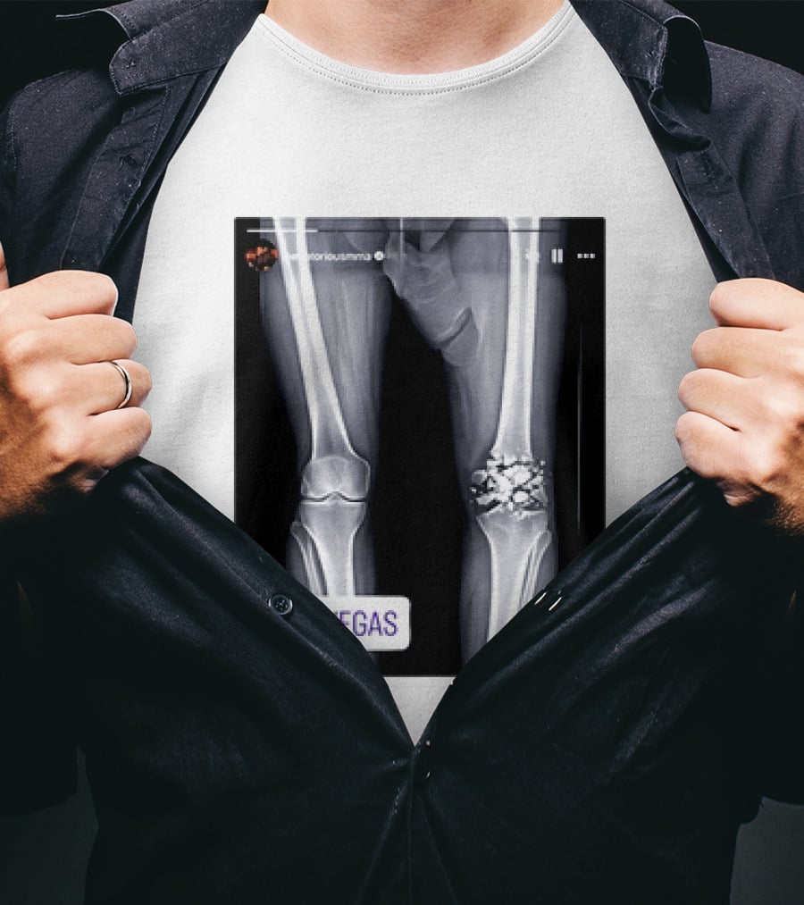 Conor McGregor X Ray Broken Knee Las Vegas T-Shirt